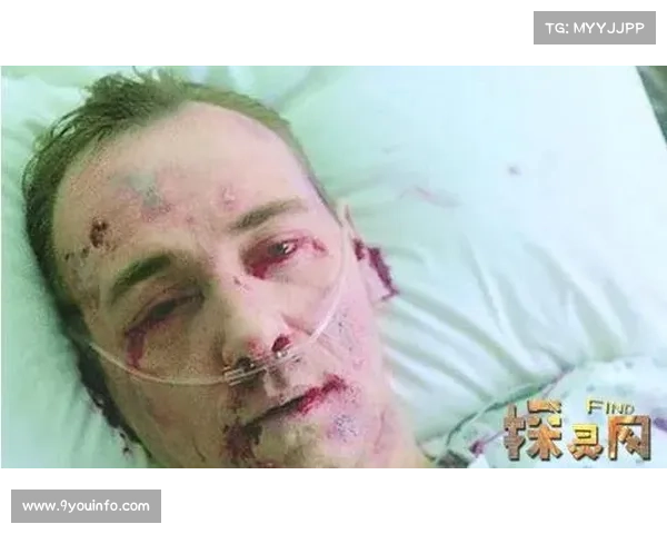 埃苏曼翻出拳台昏厥，医疗团队及时介入后苏醒无大碍